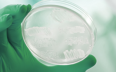 03 - �̻��� ���� ����